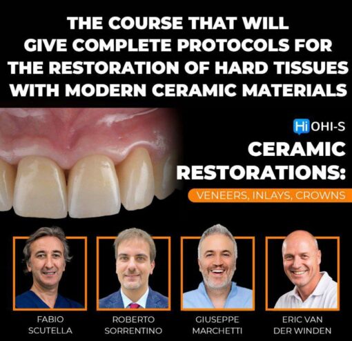 OHI-S - Ceramic Restorations: Veneers, Inlays, Crowns