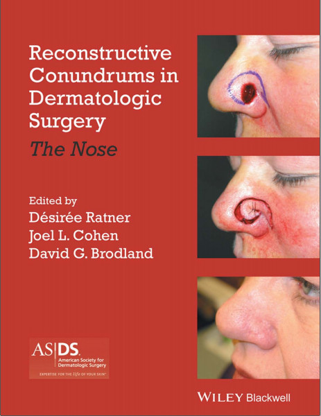 Reconstructive Conundrums in Dermatologic Surgery: The Nose 1st Edition