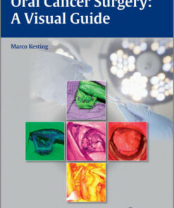 Ebook Oral Cancer Surgery: A Visual Guide 1st Edition