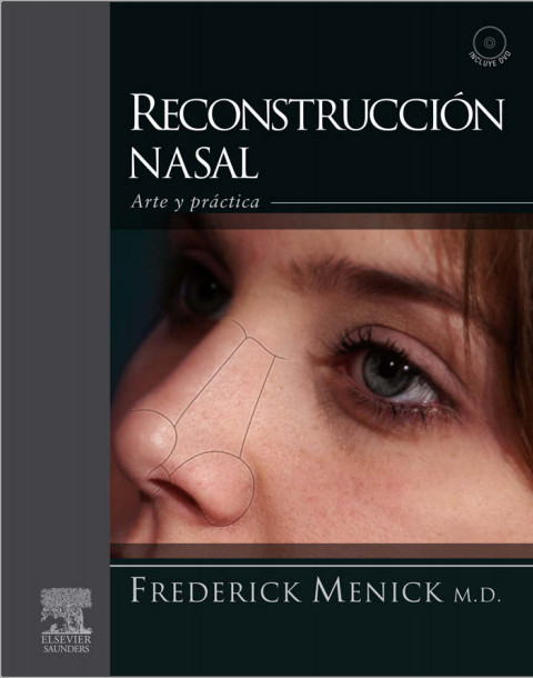 Reconstrucción nasal: Arte y práctica (Spanish Edition)