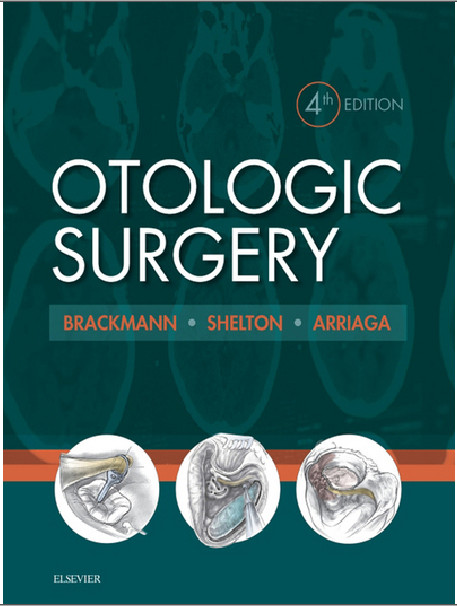 Otologic Surgery, 4 Edition