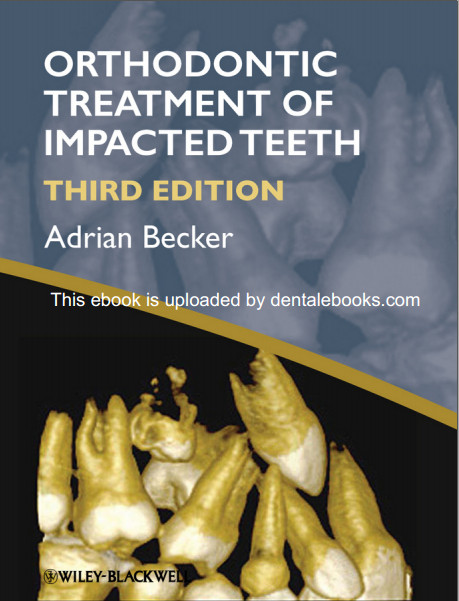 Orthodontic Treatment of Impacted Teeth 3rd Edition