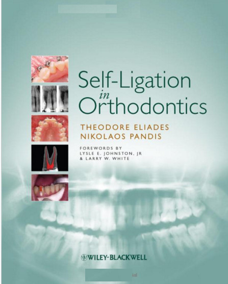 Self-Ligation in Orthodontics 1st Edition