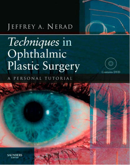 Techniques in Ophthalmic Plastic Surgery : A Personal Tutorial, 1e