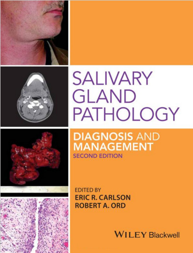 Salivary Gland Pathology: Diagnosis and Management 2nd Edition