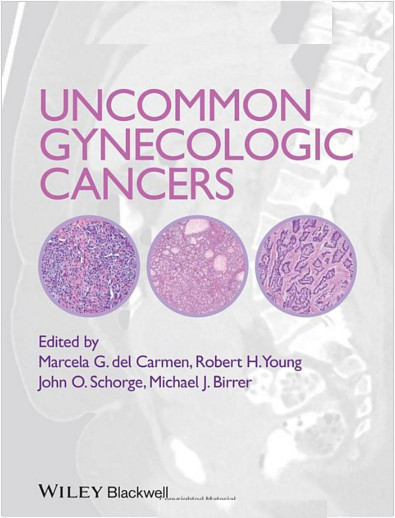 Uncommon Gynecologic Cancers 1st Edition