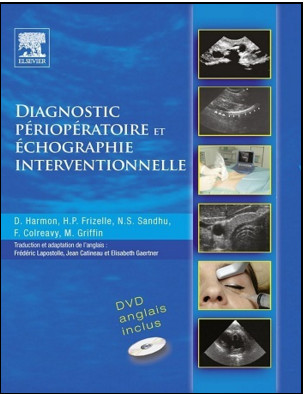 Diagnostic périopératoire et échographie interventionnelle