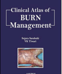 Clinical Atlas of Burn Management