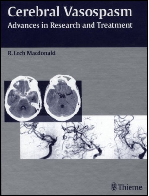 Cerebral Vasospasm: Advances in Research and Treatment