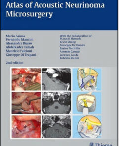 Atlas of Acoustic Neurinoma Microsurgery, 2nd Edition