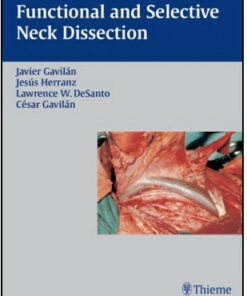 Functional and Selective Neck Dissection