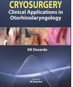 Cryosurgery: Clinical Applications in Otorhinolaryngology