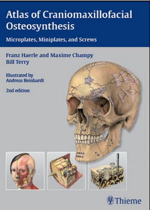 Atlas of Craniomaxillofacial Osteosynthesis: Microplates, Miniplates, and Screws, 2nd Edition