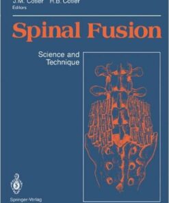 Spinal Fusion: Science and Technique
