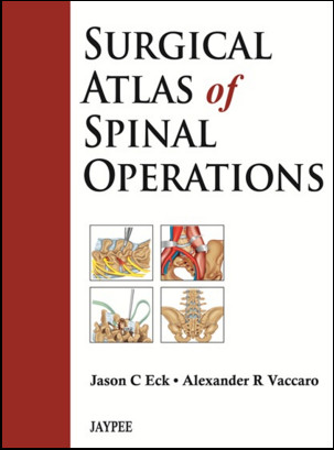 Surgical Atlas of Spinal Operations