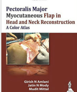 Pectoralis Major Myocutaneous Flap in Head and Neck Reconstruction: A Color Atlas 1st Edition
