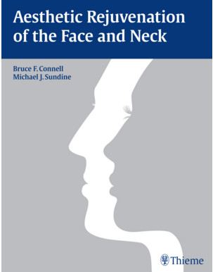 Aesthetic Rejuvenation of the Face and Neck 1st Edition