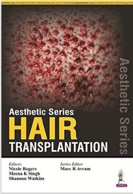 Hair Transplantation (Aesthetic) 1st Edition