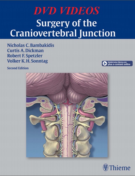 Surgery of the Craniovertebral Junction 2nd edition – Original PDF + Video