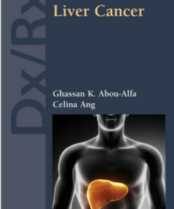 Dx/Rx: Liver Cancer (Jones & Bartlett Learning DX/RX Oncology) 1st Edition