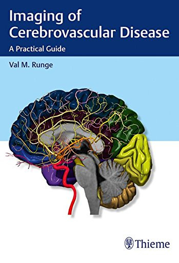 Imaging of Cerebrovascular Disease: A Practical Guide 1st Edition