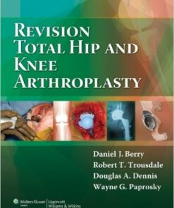 Revision Total Hip and Knee Arthroplasty 1st Edition