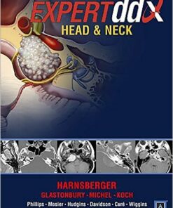 EXPERTddx: Head and Neck: Published by Amirsys® (EXPERTddx (TM))
