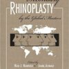 1481484806 secondary rhinoplasty by the glo.jpg