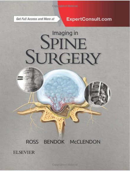 Imaging in Spine Surgery, 1e (Hot Topics)