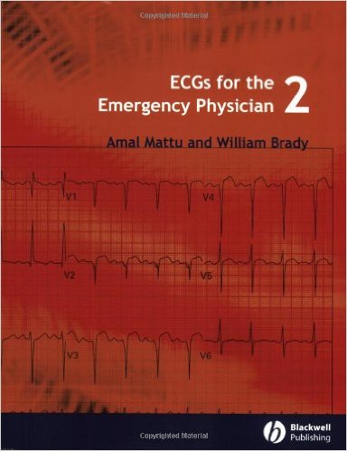 ECGs for the Emergency Physician 2
