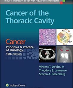 Cancer of the Thoracic Cavity : From Cancer: Principles & Practice of Oncology 10th Edition