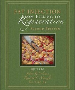 Fat Injection: From Filling to Regeneration, Second Edition 2nd Edition PDF