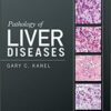 1509958447 pathology of liver diseases 231x.jpg