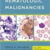 1510129544 handbook of hematologic malignan.jpg
