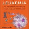 1510130798 acute leukemia an illustrated gu.jpg