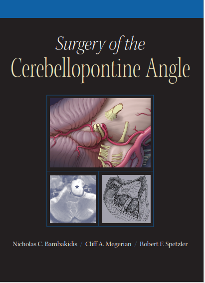 Surgery of the Cerebellopontine Angle 1st Edition PDF