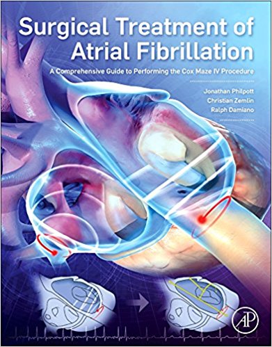 Surgical Treatment of Atrial Fibrillation: A Comprehensive Guide to Performing the Cox Maze IV Procedure 1st Edition epub