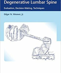 Surgical Care of the Painful Degenerative Lumbar Spine: Evaluation, Decision-Making, Techniques1st Edition PDF