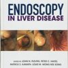 1525505629 endoscopy in liver disease 211x3 1.jpg