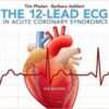 1532760238 the 12 lead ecg in acute coronar.jpg