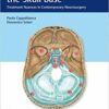 1534342363 meningiomas of the skull base 22.jpg