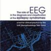 1534344130 the role of eeg in the diagnosis.jpg