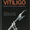 1541270088 vitiligo medical and surgical ma.jpg