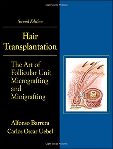 Hair Transplantation: The Art of Micrografting and Minigrafting, Second Edition 2nd Edition PDF