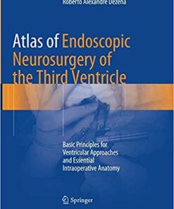Atlas of Endoscopic Neurosurgery of the Third Ventricle: Basic Principles for Ventricular Approaches and Essential Intraoperative Anatomy