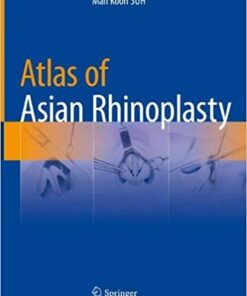 Atlas of Asian Rhinoplasty 1st ed. 2018 Edition PDF