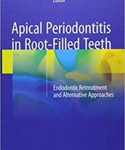 Apical Periodontitis in Root-Filled Teeth: Endodontic Retreatment and Alternative Approaches 1st ed. 2018 Edition PDF