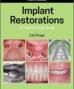 Implant Restorations: A Step-by-Step Guide 4th Edition PDF