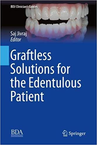 Graftless Solutions for the Edentulous Patient (BDJ Clinician’s Guides) 1st ed. 2018 Edition PDF