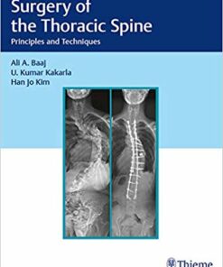 Surgery of the Thoracic Spine: Principles and Techniques 1st Edition